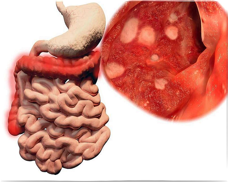 There are microorganisms present in the soil