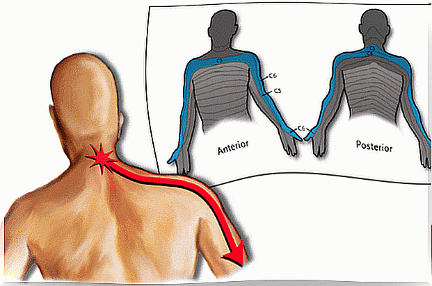 Cervicobrachialgia has multiple causes.