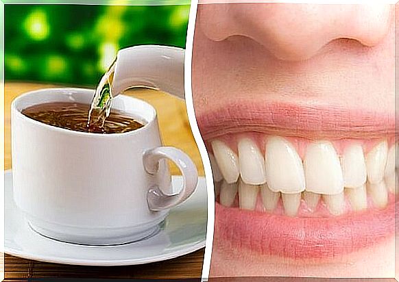 Is drinking too much tea bad for your teeth?