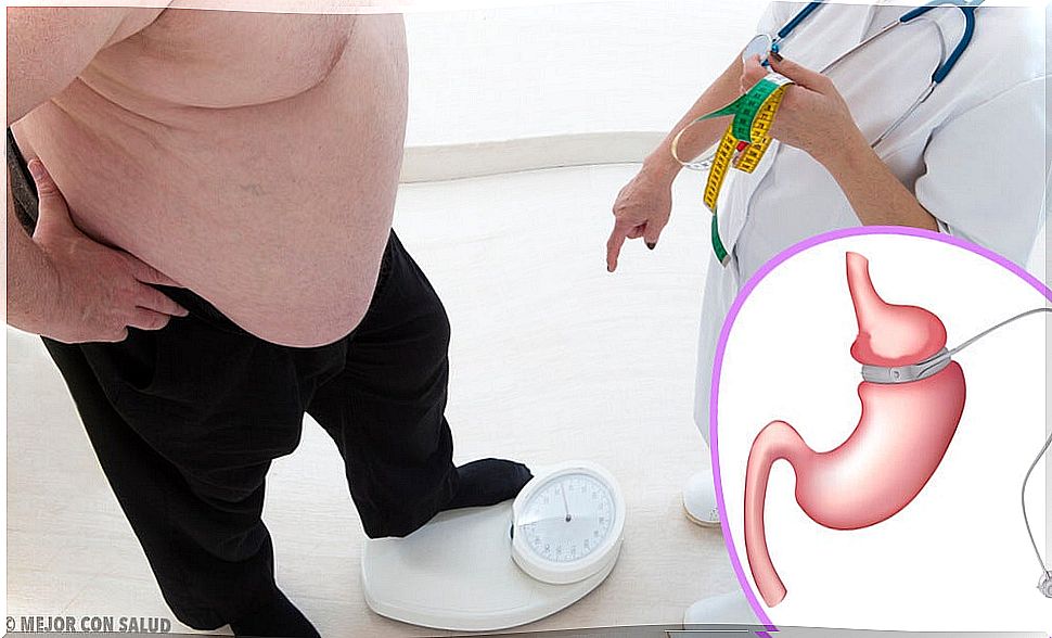 Gastric bypass: what is it and what does it consist of