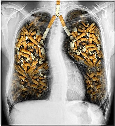 Smoking can cause lung disease